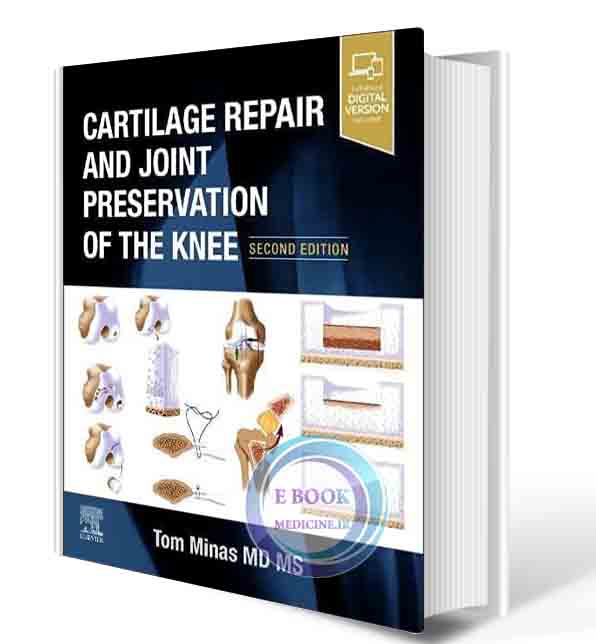 دانلود کتاب Cartilage Repair and Joint Preservation of the Knee 2nd  2021 (ORIGINAL PDF)